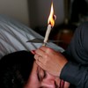 Sveća za čišćenje ušiju nisu bezbedna opcija za uklanjanje ušne masti