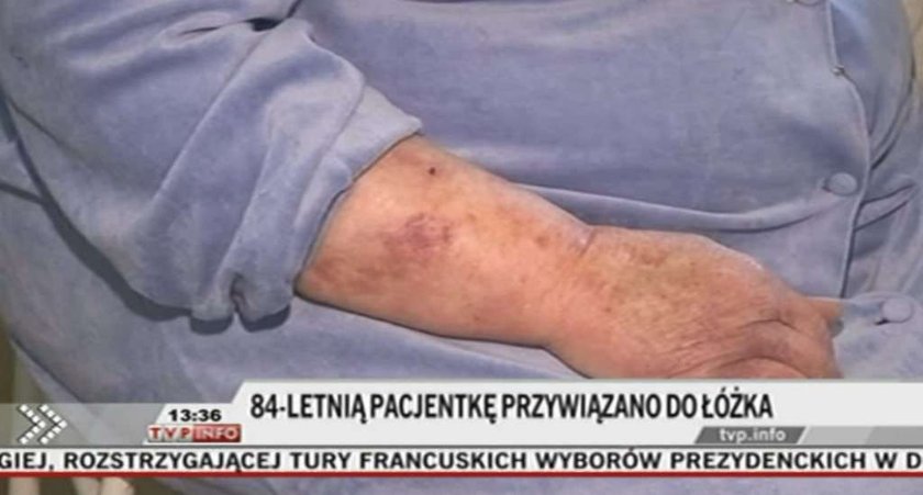 Naga pacjętka przywiązana do łóżka