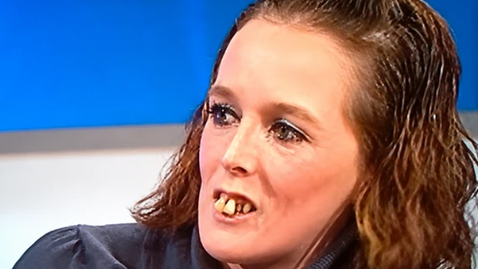 Nazývali ju "žena s konskými zubami".