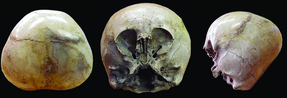 Niezwykła czaszka została odnaleziona w szybie kopalnianym w Meksyku