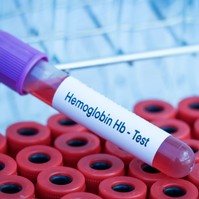 Alacsony hemoglobinszint  - ebben az esetben már igen veszélyes