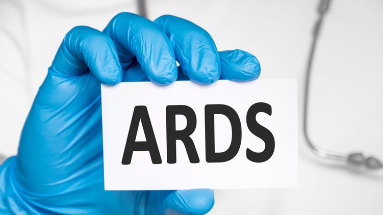 Akut légúti distressz szindróma ARDS