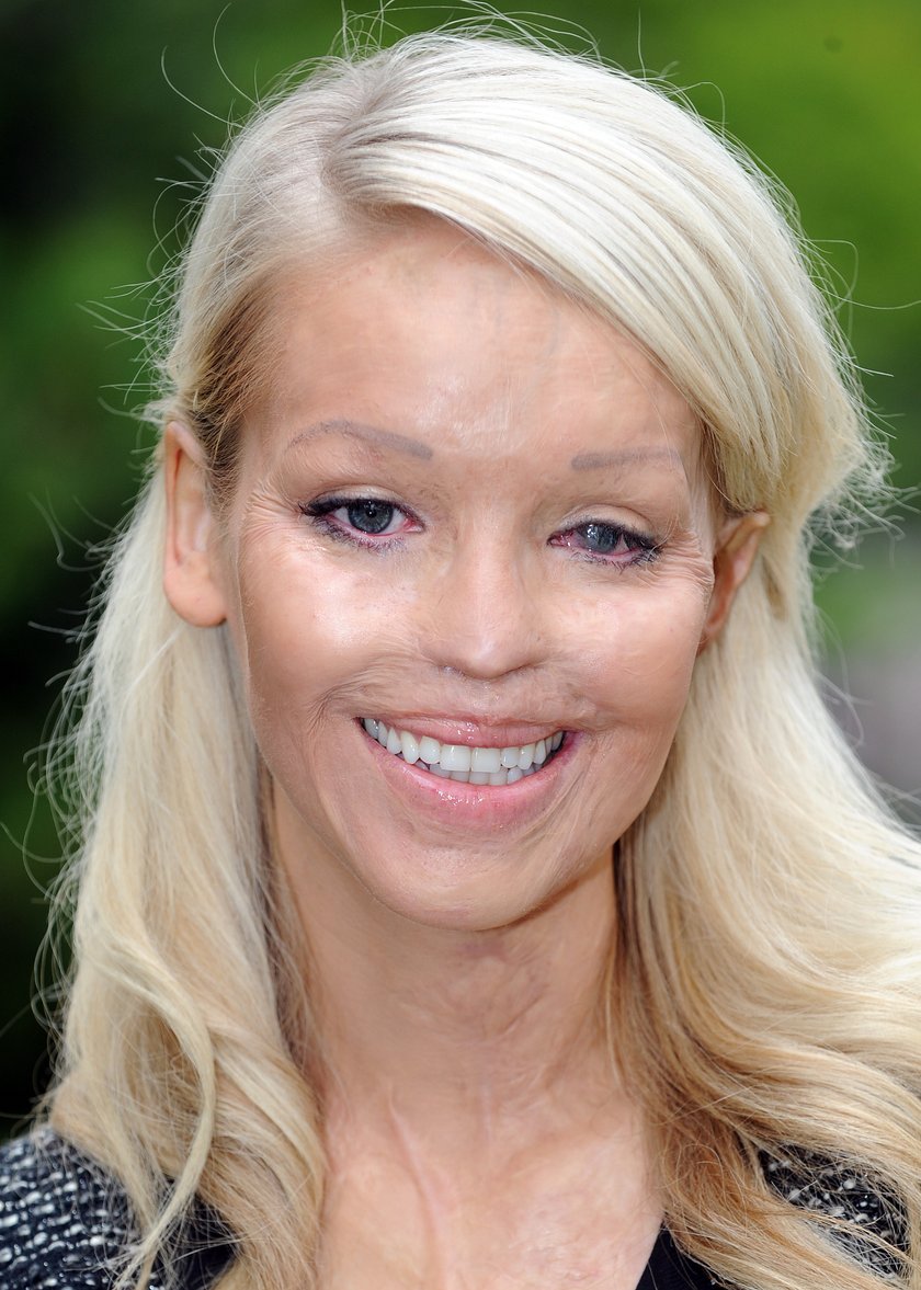 Katie Piper