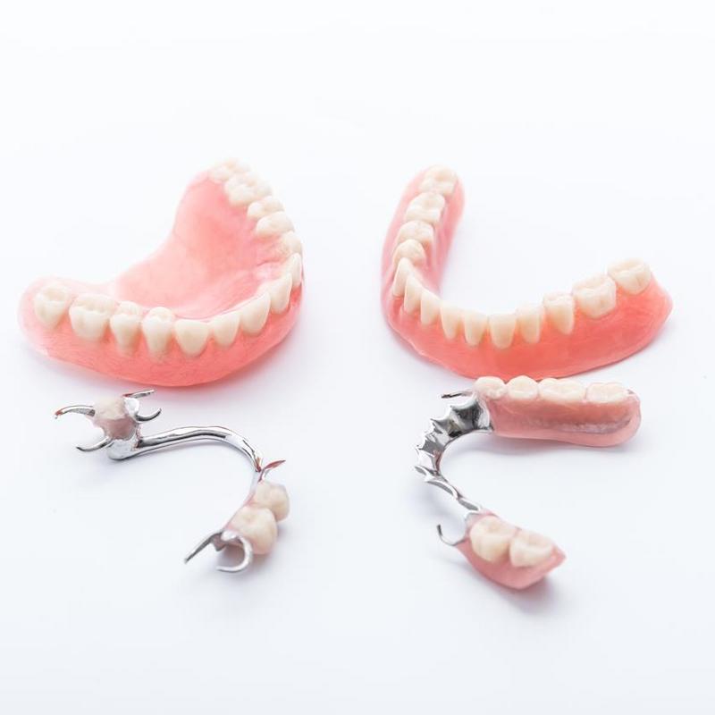 Proteza szkieletowa na zęby - kiedy może być potrzebna? Ile kosztuje proteza  szkieletowa?