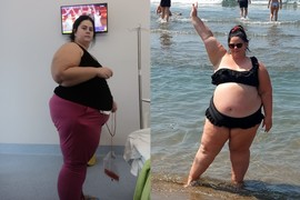 Milana iz Zrenjanina je imala 165 kg, a onda je jedan poziv sve promenio i SMRŠALA JE 72 kg: Nećete verovati kako sada izgleda