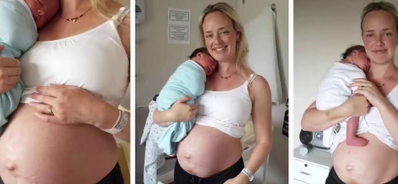 Blogerka pokazała swoje ciało po porodzie. Niektórych zaskoczą te zdjęcia