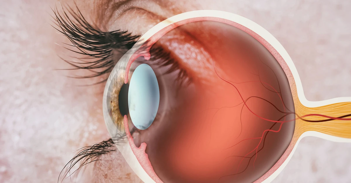 Zespół suchego oka pod lupą naukowców. Jak gruczoły łzowe z komórek macierzystych pomagają zrozumieć chorobę i szukać nowych terapii