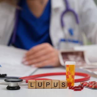 A nagy imitátor: a lupus korai tünetei, amelyeket soha ne hagyjon figyelmen kívül