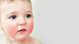 Ryzyko niedoborów żywieniowych u dzieci z alergią na białka mleka krowiego – jak mu zapobiegać?