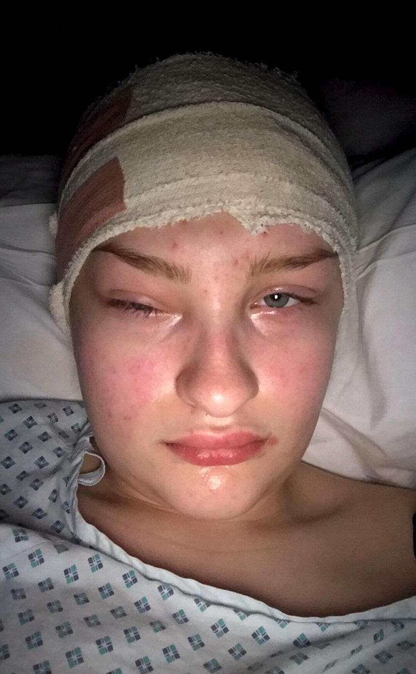 19-letnia Megan Barker była pewna, że ma alergię. Okazało się, że to guz