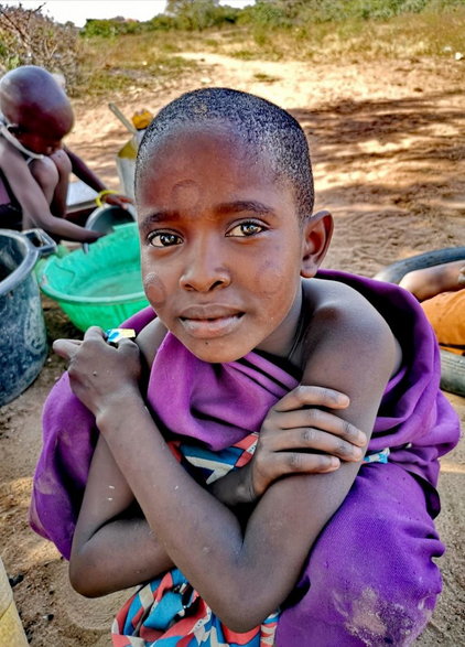Masajskie dziecko z wypalonymi znakami.