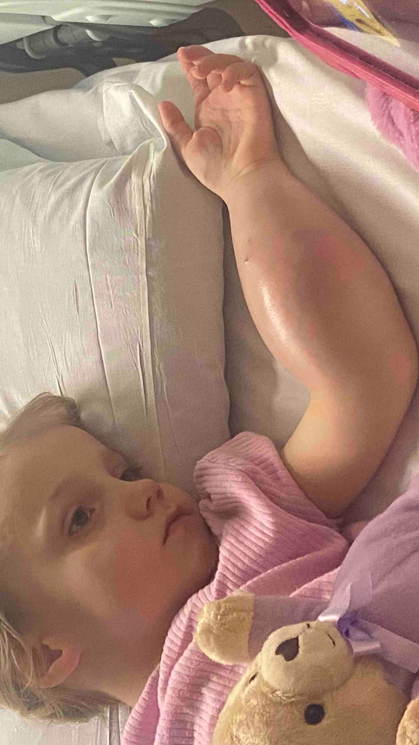 Bonnie diagnostikovali zriedkavú formu rakoviny.