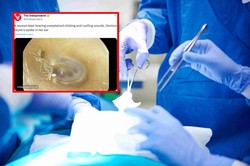 Kobieta słyszała dziwne dźwięki. Lekarze znaleźli w jej uchu coś okropnego