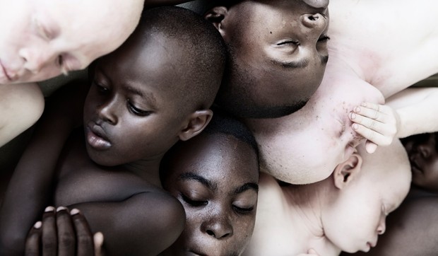 albino01 foto profimedia