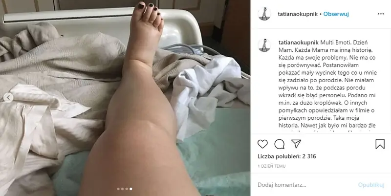 Tatiana Okupnik pokazała zdjęcia po porodzie / Instagram Tatiany Okupnik