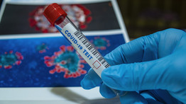 Koronavírus: új járványügyi intézkedések lépnek érvénybe Horvátországban