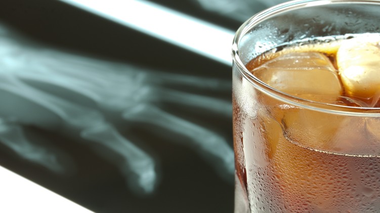 alkohol rá alkoholfogyasztás dagnataos betegség