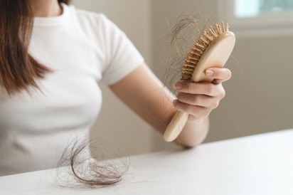 Hajhullás: ezek a hormonzavarok okozzák a leggyakrabban