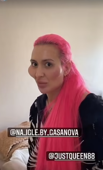 Anastasiia po zákroku