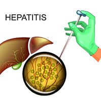 Ingyenes Hepatitis C szűrés országszerte: ezek a helyszínek