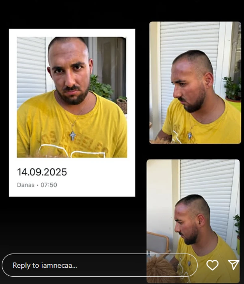 Peca Lazić nakon incidenta