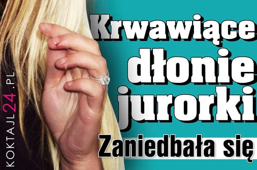 Krwawiące dłonie jurorki. Zaniedbała się