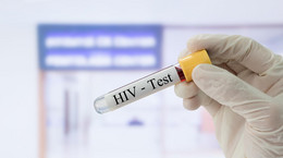 Zmiana polityki wobec lekarzy zakażonych HIV