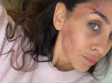 CELA U MODRICAMA! Sprska glumica (34) podelila prizor od koga su se SVI NAJEŽILI: Evo šta se dogodilo! (FOTO)