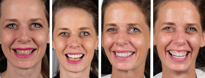 Ručnim radom do prirodnog izgleda 