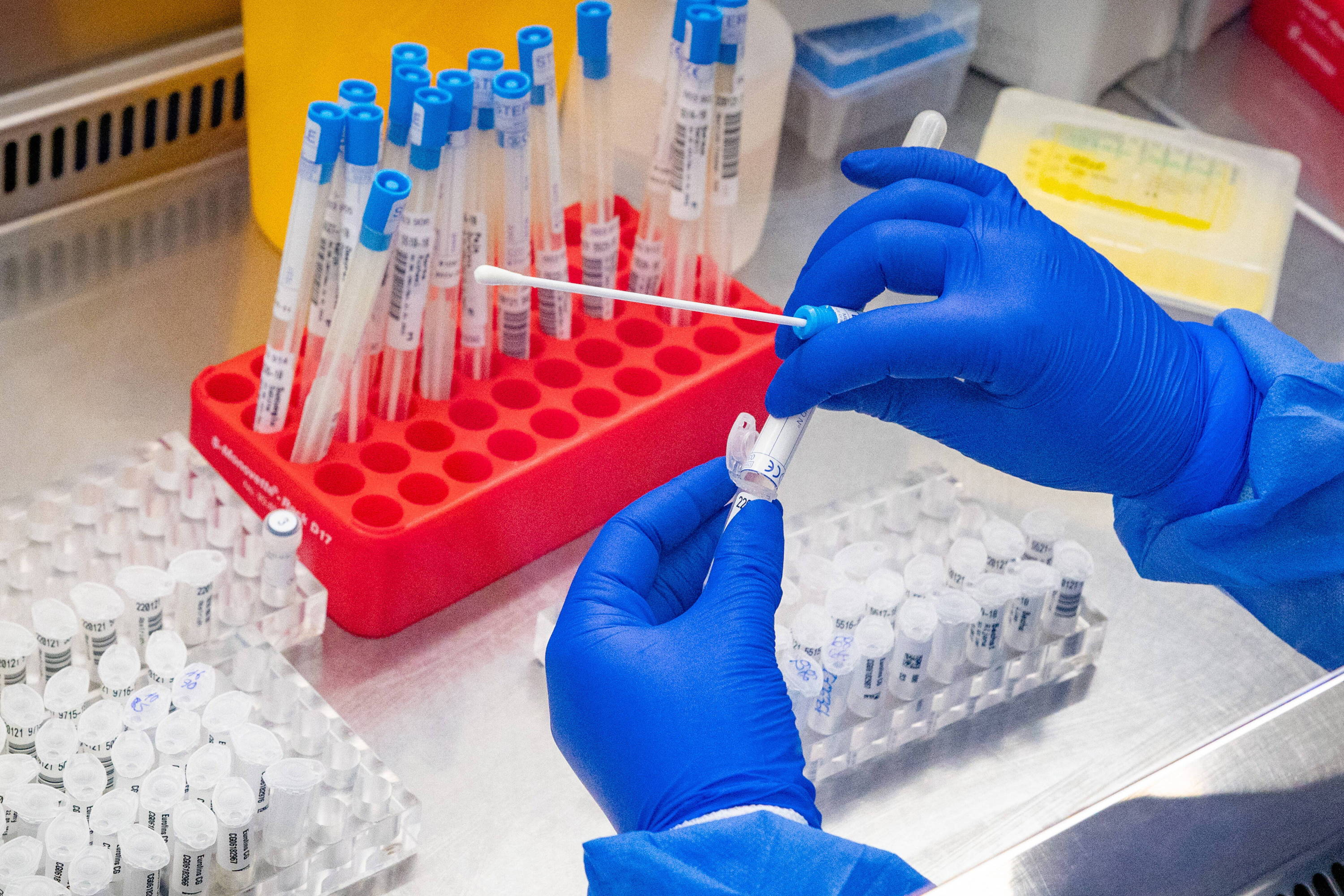 Nowy, hybrydowy wariant ospy małpiej wykryty w Wielkiej Brytanii