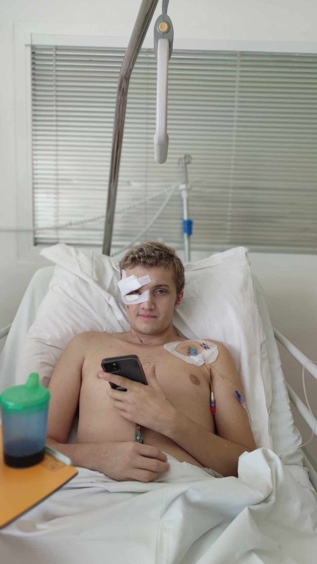 Pre Tomáša malo nakazenie sa kiahňami škaredé následky.