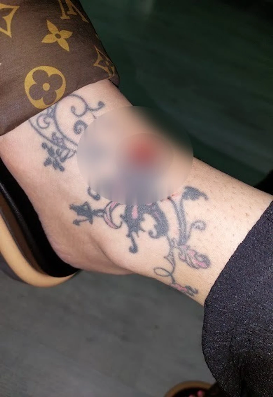 Jelena Radanović povrede