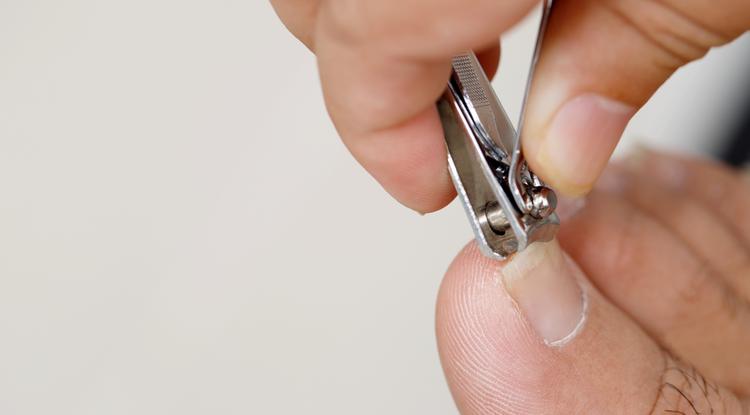 Ha így vágod le a körmöd, soha többé nem nő be Fotó: Getty Images