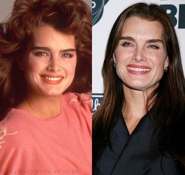 26060_brooke-shields-arcplasztika-sl-d0001717Ff5078cb33023