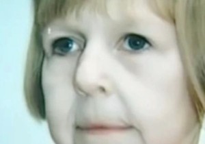 Katja je rođena sa licem starice, muž je tukao i javno je ponizio