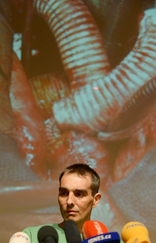 Jakub Halik żyje, choć nie ma serca