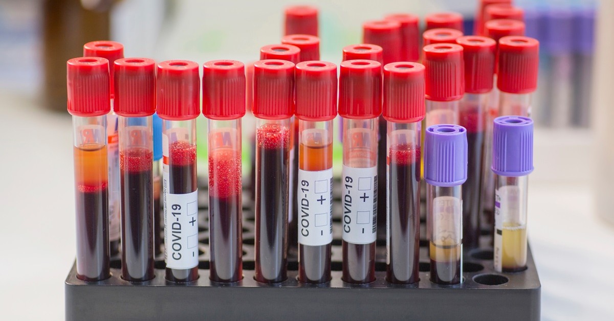 Naukowcy odkryli anomalię we krwi osób z COVID-19. Może tłumaczyć przewlekłe objawy