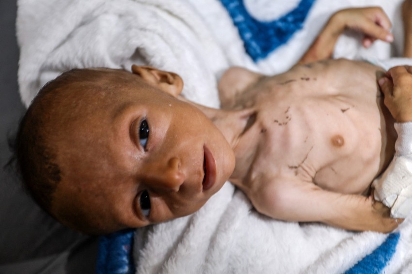 Deca umiru od gladi u Gazi