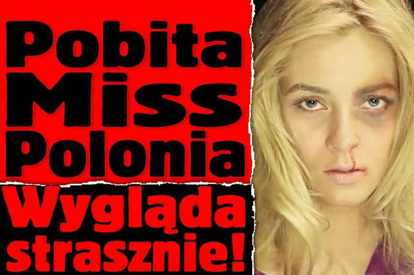 Pobita Miss Polonia. Strasznie wygląda!