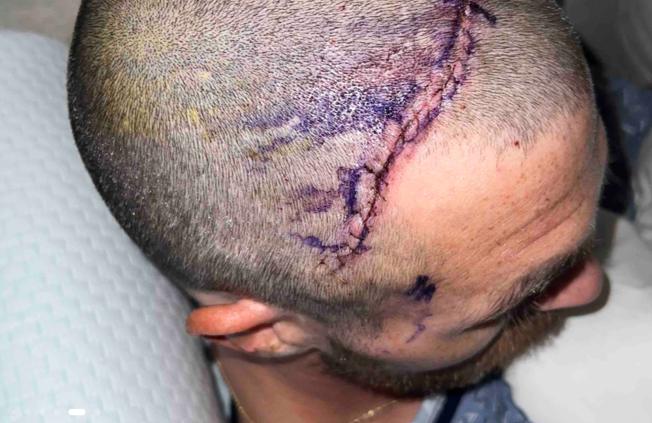 Autonehoda Tylerovi zachránila život.