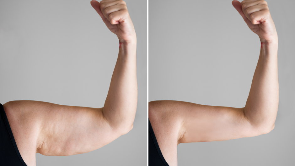 Modelujący koncentrat poprawi wygląd skóry na ramionach