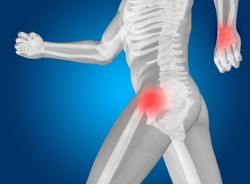 Eksperci: Roboty cennym wsparciem rehabilitacji chorych neurologicznie