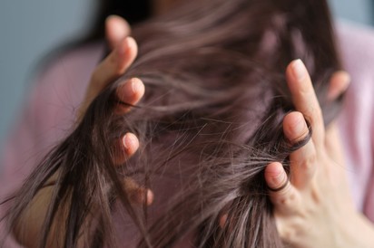 Tényleg megfázhatnak hajhagymáink a hidegben? Így védje a haját télen