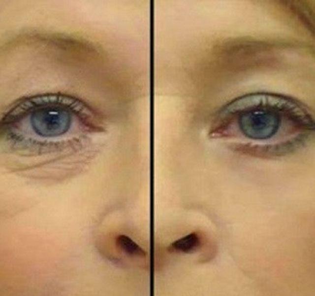 helena egész test anti aging bőrfiatalító