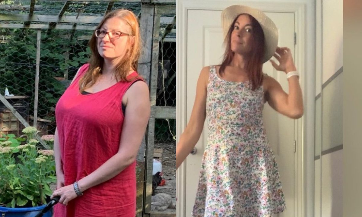 Miała biust w rozmiarze 34G. Zdecydowała się na operację, która "zmieniła jej życie"