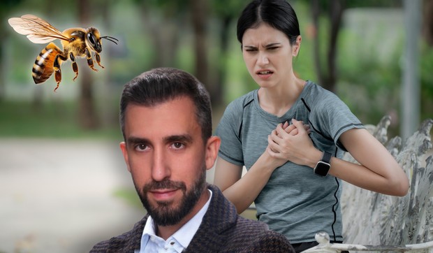  Kounis sindrom je alergijska reakcija nakon uboda pčele koja dovodi do infarkta