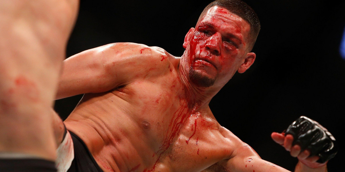 Walka roku w UFC! Niesamowticie krwawy spekakl