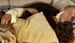 Psi lutalice napale bivšeg specijalca