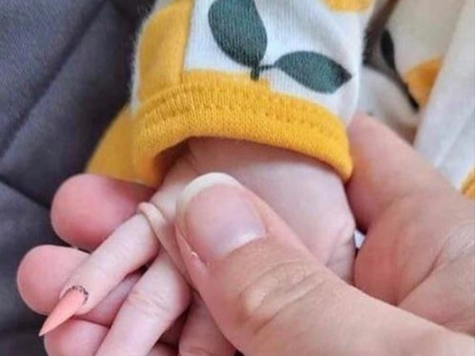 Zaista uznemiravajuća fotografija