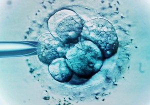 BBC | Foto: Getty Images